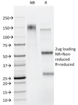 Fas/TNFRSF6/CD95 Antibody (B-R18), Novus Biologicals:Antibodies:Primary